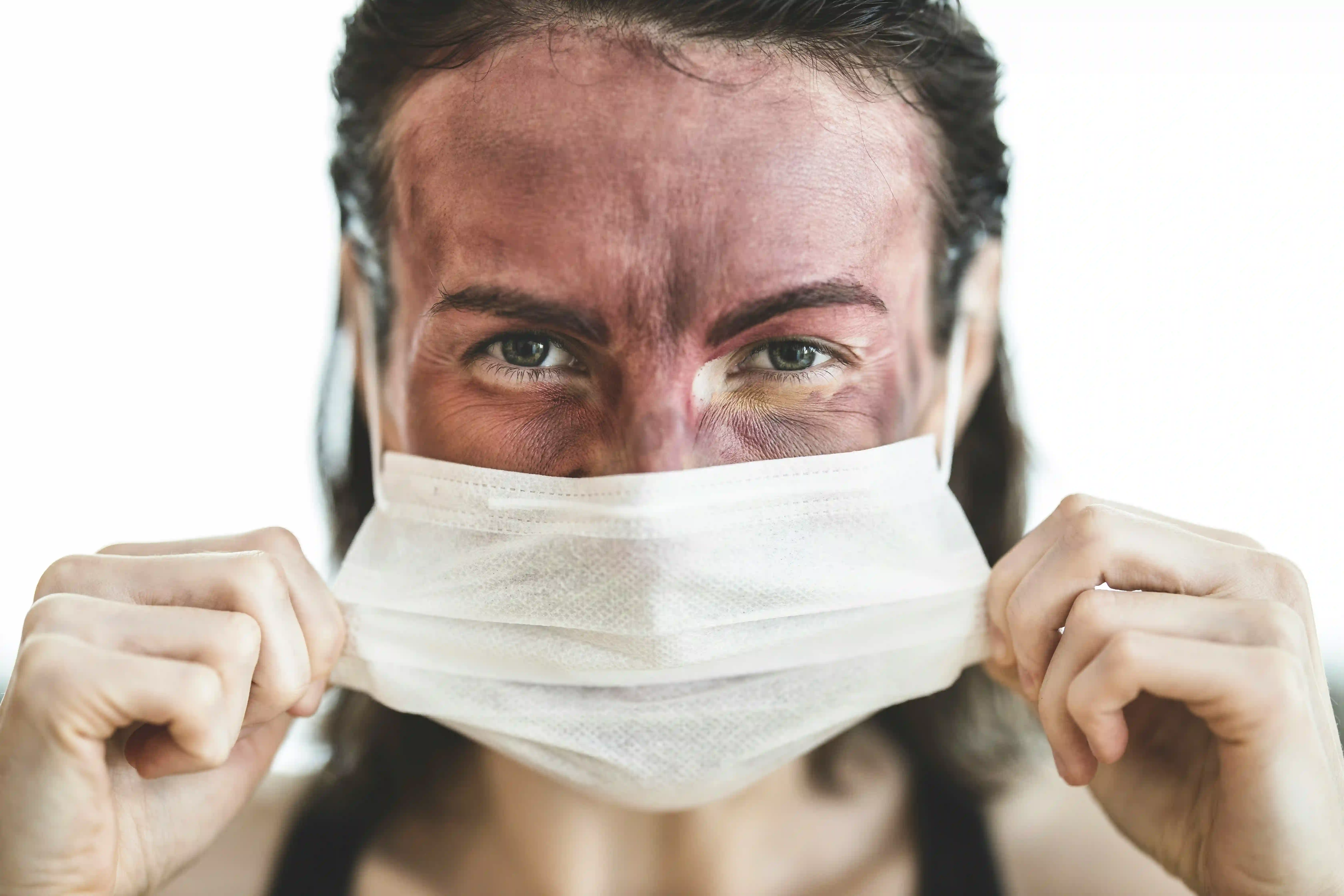 A picture showing a woman with either an allergy or the common cold.