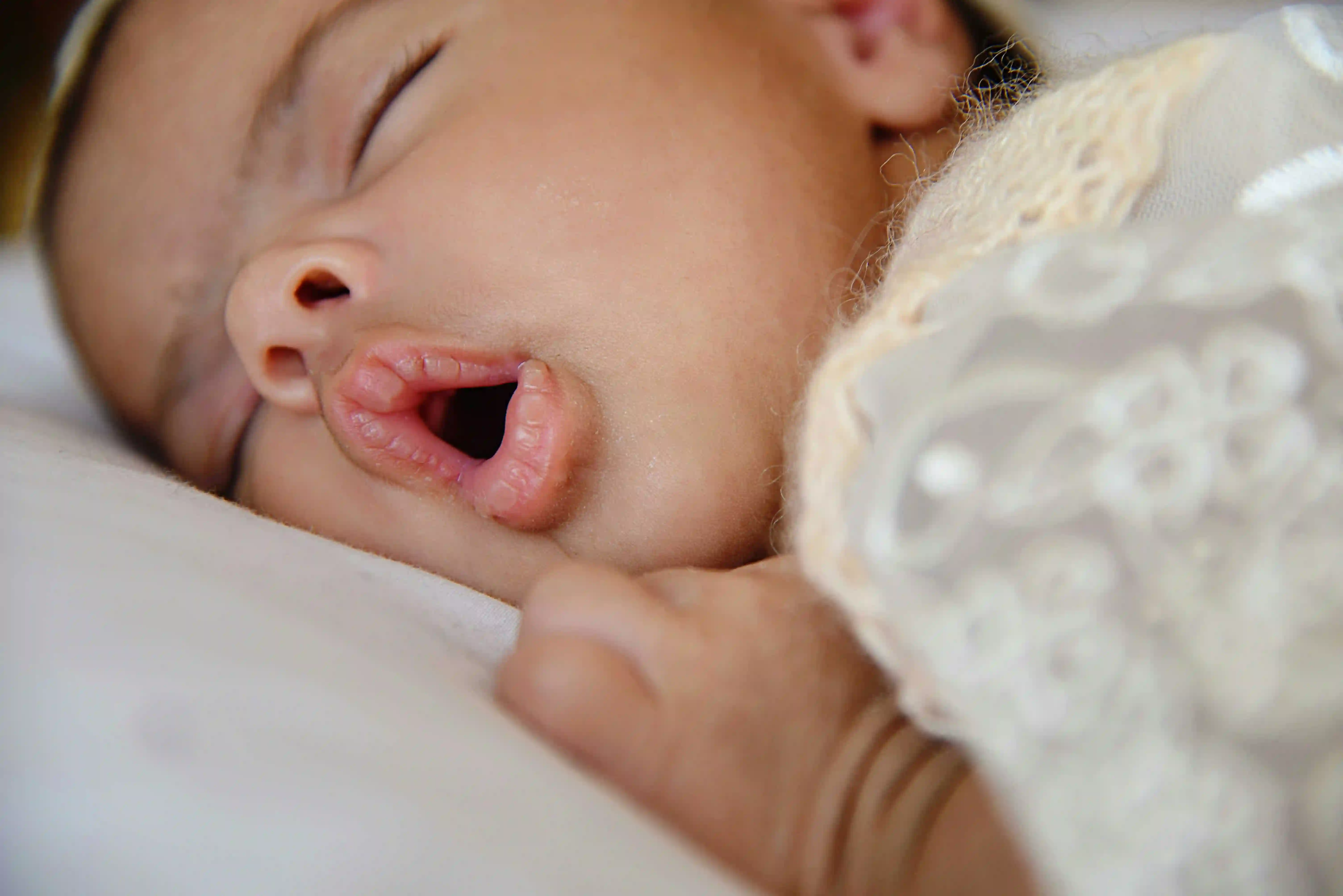 A picture showing a person sleeping whilst mouth-breathing.